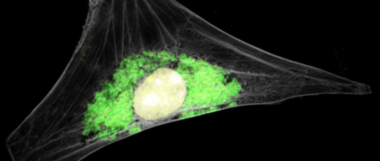Guinea pig cell infected with Chlamydia caviae - marsvin cell smittad med klamydia