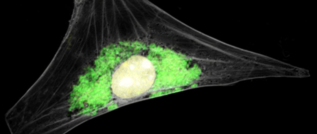 Guinea pig cell infected with Chlamydia caviae - marsvin cell smittad med klamydia