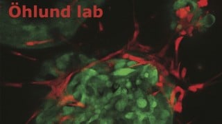 A picture of Cell culture of stromal cells, in red, and cancer cells, in green. In these co-cultures the interactions between cancer cells and stromal cells can be studied