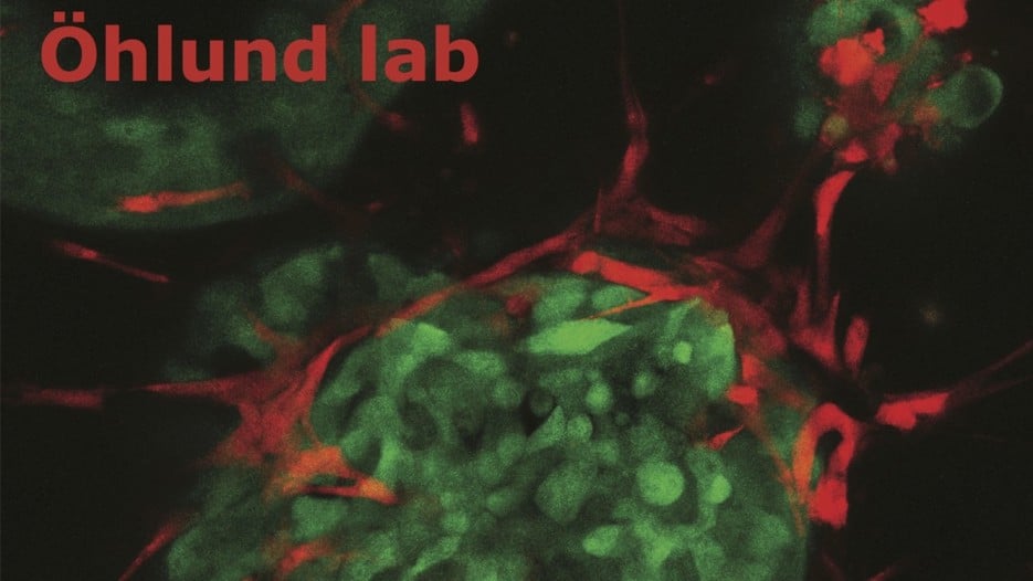A picture of Cell culture of stromal cells, in red, and cancer cells, in green. In these co-cultures the interactions between cancer cells and stromal cells can be studied